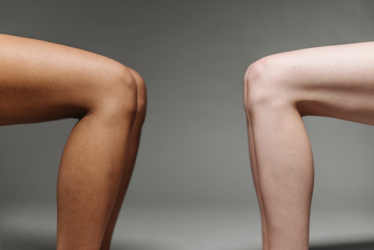 L’olio per cellulite fatto in casa con ingredienti naturali
